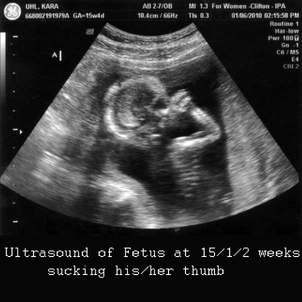 fetus ultrasound